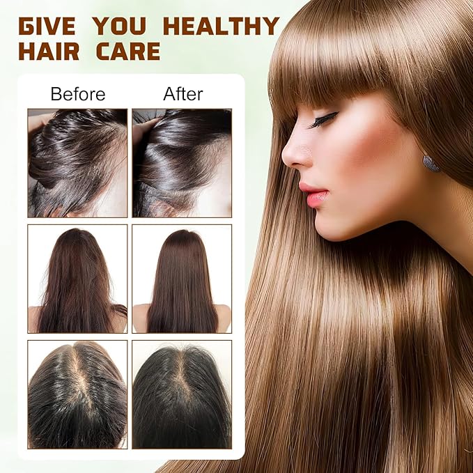 100% Natural Raw Batana Oil for Hair Growth,Dr Sebi Hair Growth Oil From Honduras,Unrefined Hair Oil,Natural and Pure,Prevents Hair Loss and Promotes Hair Thickness for Men and Women(2 Bottles)