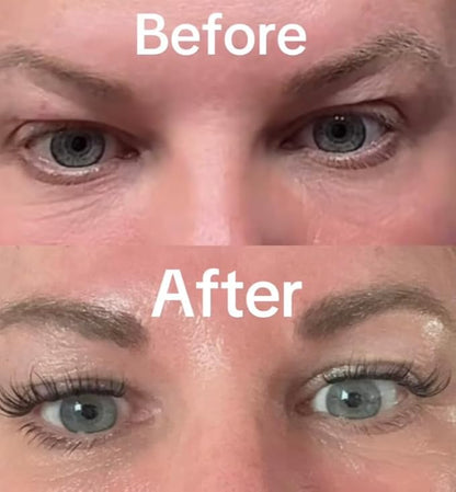 Intoxicated Cosmetics Snake Eyes Eye Serum 15 ml - Bakuchiol Under Eye Solution for Women and Men - Lift | Tighten | Brighten