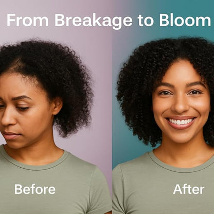 Babassu & Bloom Strengthening Growth Oil, Hair Revitalizing Oil, Multi-Purpose, Cactus & Argan, Potent, Lightweight, Non-Greasy, Soothes Scalp, Reduces Dryness, Thickens Hair