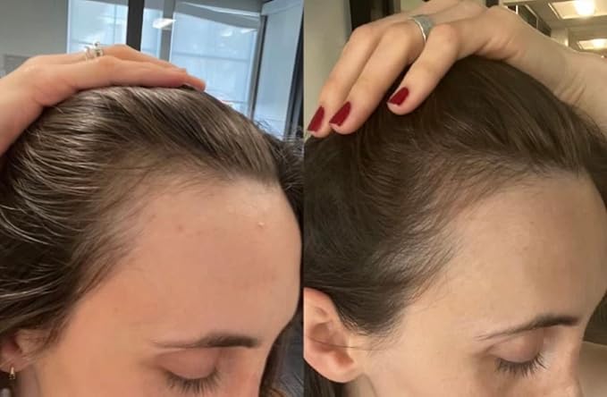 BUR BUR Growing Season Hair Growth And Repair Oil | With Burdock, Nettle Oil and Vitamin C for Visibly Fuller, Stronger and Shinier Hair.