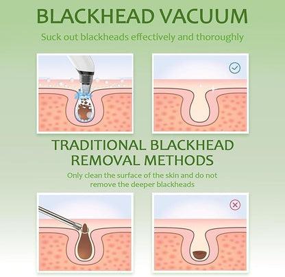 Blackhead Remover Pore Vacuum - Facial Pore Cleaner with 3 Adjustable Suction Levels, 4 Blackhead Removal Tools, Electric Acne Extractor Tool for Women & Men