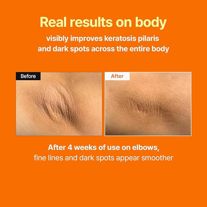 MEDITHERAPY Retinal Skin Booster Serum – Beginner Friendly Non-Irritating Retinaldehyde for Face and Body – Anti-Aging Retinol Pore Minimizer for Blemish Prone Skin– Korean Skin Care, 5.07 Fl.Oz Large
