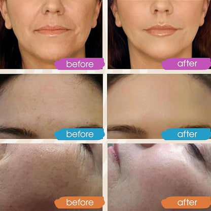 GLEOW New 2024 Pure Hyaluronic Acid Serum for Face - Hydrating Serum for Women - Hyaluronic Acid Pure Face Serum for Women - Face Serum for Dry Skin with Dark Spots 2oz