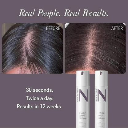 NULASTIN Scalp Serum - Vibrant Scalp Treatment to Help Improve the Look of Hair Density - Lightweight, Fast Absorbing Formula Enriched with Hair-Strengthening Ingredients (1.7 Oz)