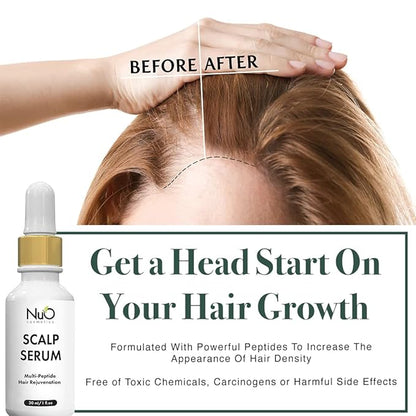 nuorganic Dry Scalp Serum to Hydrate and Moisturize Hair Follicles — Reduce Hair Loss, Flakiness, Dryness and Itch All in One — Vegan & Organic (1 fl.Oz / 30ml)