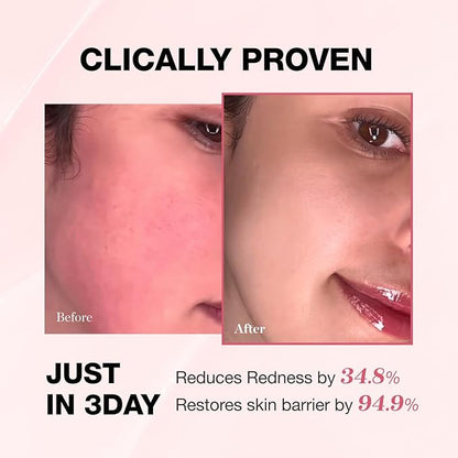Physiogel Redness Reducing Cream – Ceramide Moisturizer for Dry, Sensitive & Redness-Prone Skin, Repairs Skin Barrier, Dermatologist-Tested, Fragrance-Free, Korean Skincare, 3.4 fl oz