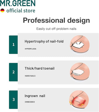 MR.GREEN Toenail Clippers Stainless Steel Ingrown Nail Cutter Thick and Hard Nails Pedicure Manicure Tools (Orange)