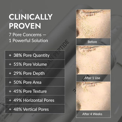 MIZON 7 Vegan Peptide Booster Serum Korean Anti-Aging Face Serum with Niacinamide & Hyaluronic Acid Hydrating Firming & Smoothing Skincare for Fine Lines & Skin Repair – 5.07 fl oz
