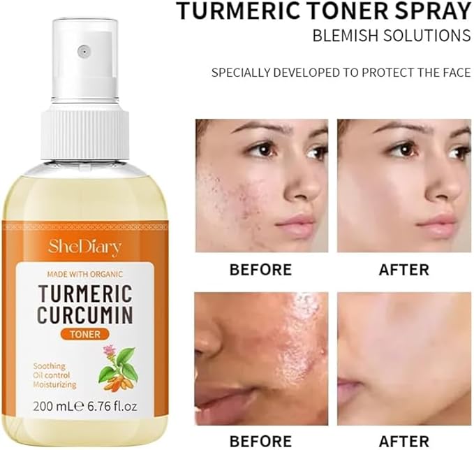 Turmeric Toner Spray Calming Hydrating Soothing Oil Control Moisturizing Face Mist (4)