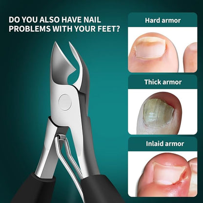 DEOU Heavy Duty Large Opening toenail Clippers, Suitable for Embedded Growth and Rough Nails, Home Pedicure Tools for Men, Women, Elderly Newly Upgraded Stainless Steel (Nail Clippers+Gift Box)