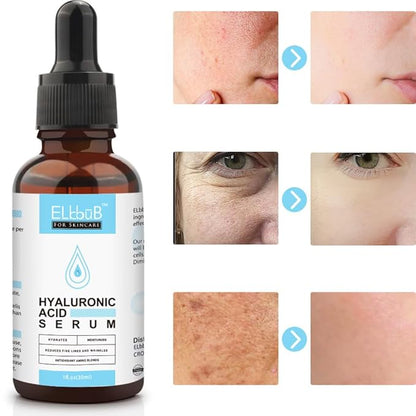 Anti Aging Vitamin C Serum Hyaluronic Acid Serum Set - with Hyaluronic Acid, Skin Care Set Boost Skin Collagen,Hydrate & Plump Skin, Anti Aging & Wrinkle Facial Serum