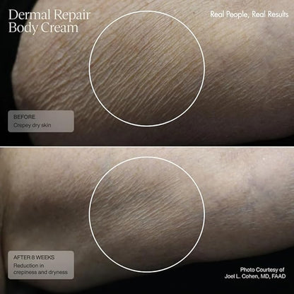 Senté Dermal Repair Body Cream | Restore Skin's Barrier | Soothes Sensitive Skin | Promotes New Collagen Production for Firmer Skin | 6 Fl Oz