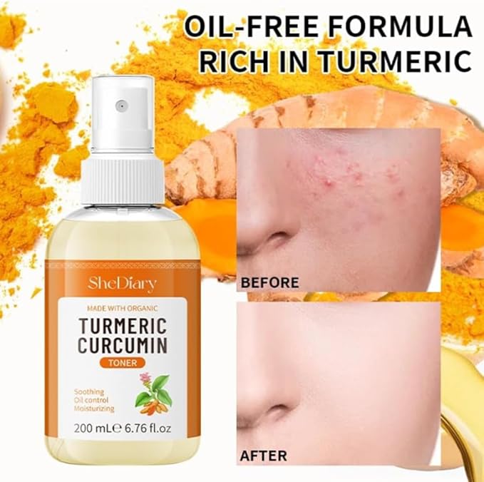 Turmeric Toner Spray Calming Hydrating Soothing Oil Control Moisturizing Face Mist (4)