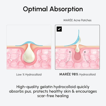 MAREE Invisible Pimple Patches - Clear Pimple Patches for Face - Hydrocolloid Acne Patches Anti Blemish - Zit Stickers for Face - Parches Para Acne - Pinple Zit Patches Pimple Stickers - 72 Dots