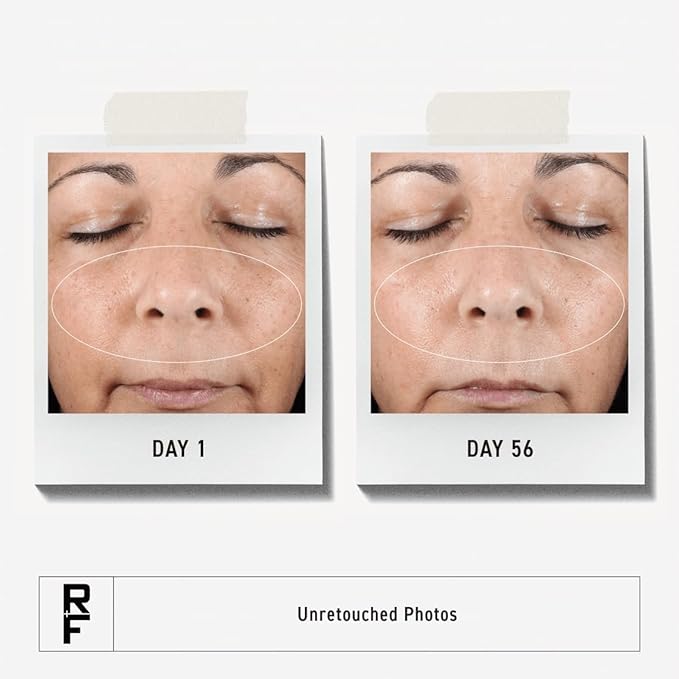 Rodan + Fields Active Hydration Serum | 1oz | Boosts Hydration Levels | Glycerin | Hylauronic Acid