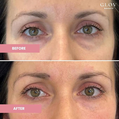 Glov Beauty - Hydrate & Brighten Eye Cream - Anti-Aging Under Eye Cream for Dark Circles, Wrinkles & Puffiness - With Retinyl Palmitate, Sodium Hyaluronate & Niacinamide - All Skin Types