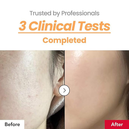 Skin Texture Booster 214% Essence – Deep Hydration, Glass Skin, Triple Hyaluronic Acid, Collagen & Retinol, Lightweight & Non-Sticky, Visibly Plumping Effect, Korean Skincare, 5.07 fl oz