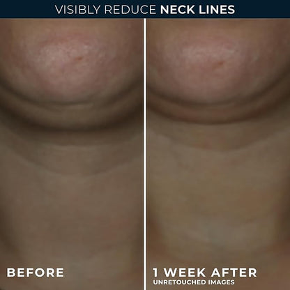 RoC Derm Correxion Neck Cream with Hyaluronic Acid + Advanced Retinol to visibly Tighten & Lift Horizontal Neck Lines, Facial Moisturizer to Contour Face (1.7 oz) with RoC Retinol Eye Packette