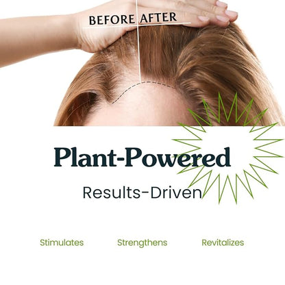 Isabella's Clearly GAIN, Hair Thickening Serum for Men and Women | Natural Herbal Scalp Oil with Castor, Jojoba, Clary Sage, Rosemary, Nettle Extract for Hair Loss, Thinning Hair | Made in USA