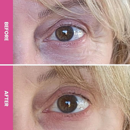 PRIME PROMETICS PrimeEyes Hydrate Under Eye Cream for Mature Women – Hydrating Eye Cream for Dark Circles and Wrinkle Repair – Soft, Glowing & Healthy Under Eyes