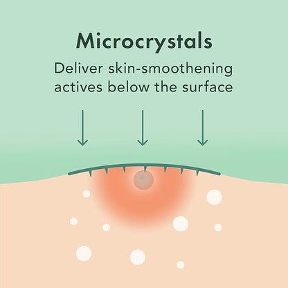 Rael Pimple Patches, Miracle Microcrystal Spot Cover - Hydrocolloid Acne Patch with Tea Tree Oil, Early Stage Zits and Blemish, Korean Skin Care (27 Count)