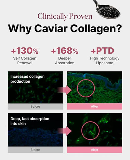 Delere Caviar Glow Smoothing Serum | Caviar Collagen with Niacinamide and Retinol for Face | Korean Serum for Glowing Skin and Radiant Glass Skin, 1.7oz