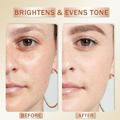 Vitamin C Serum for Face Skin Care Illuminating Serum with Hyaluronic Acid & Collagen, Brightening, Antioxidant, Anti Aging Wrinkles, Glow, Dark Spots Remover Women Hydrating Facial Serums 30ml/1.01oz