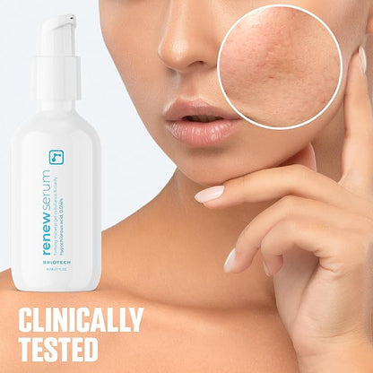 BRIOTECH Renew Serum, Hypochlorous Acid Mineral Gel, Soften Fine Line Appearance, Smooth Skin for Face, Neck, Chest, Spot Corrector, Soothe Redness, Vegan, 2 fl oz