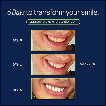 Laughland Super Strength Teeth Whitening Gel 3 Pack, Tooth Whitener, 11% Hydrogen Peroxide, Glycerin, Aloe Vera & Mint, at Home Dental Care, Travel Friendly, 6 Treatments