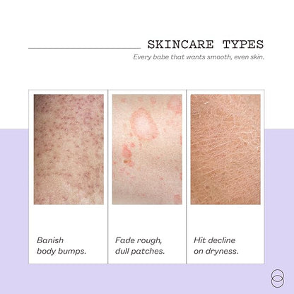 frank body Niacinamide Body Scrub | Fights Breakouts & Dryness | Exfoliating Body Scrub | Berry Extracts & Green Tea | Berry Scent | Vegan & Cruelty Free | 250g / 8.82 oz
