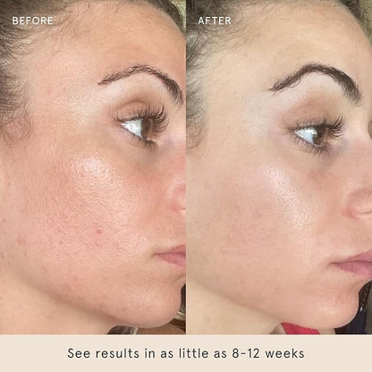 Barefaced Clear Skin Duo - Toning Pads & Toning Pads II - Renew, Resurface and Clear Dull, Dry or Acne-Prone Skin