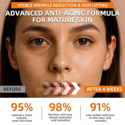Super 22% Vitamin C Retinol Serum for Face: Advance Anti-Aging & Brightening Formula with Hyaluronic Acid, Niacinamide, Collagen, Peptides - Hydrates, Smooths, Targets Age Spots, Wrinkles, 1.7 Fl Oz