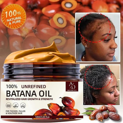 100% Unrefined Raw Batana Oil for Hair Growth Dr. Sebi Organic Pure from Honduras with Keratin, Coffee Extract & Other Ingredients to Enhance Efficacy for Thicker, Strength - Botana Oil 4oz