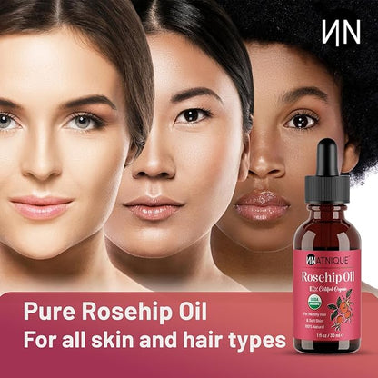 Natnique Organic Rosehip Seed Oil, 1 oz – USDA Certified Cold-Pressed Moisturizer for Face, Skin & Hair – Natural Hydrating Serum for Wrinkles & Fine Lines – Ideal for Gua Sha Massage & Radiant Glow