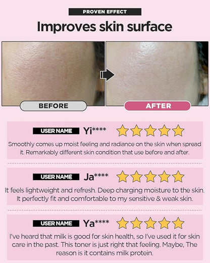 SKINRxLAB MadeCera Cream Double Essence Korean Toner 150ml (5.07fl.oz.) - Hydrating and Soothing with Milk Protein, Ceramide, Beta-Glucan - Moisturizing Strawberry Milky Toner for Irritated Skin