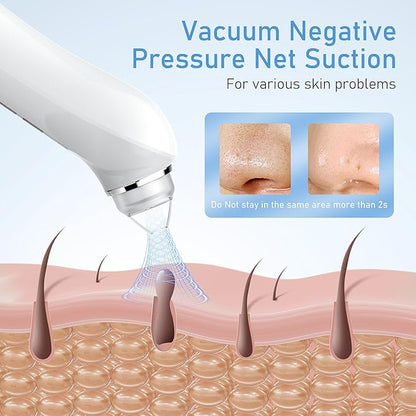 Facial Pore Blackhead Remover Vacuum, 1080P Camera Blackhead Remover, 20x Zoom, 8 LEDs ＆ 3 Suction Modes, 800mAh Battery & USB - 6 Heads Pore Cleaner Kit for Women&Men(White)