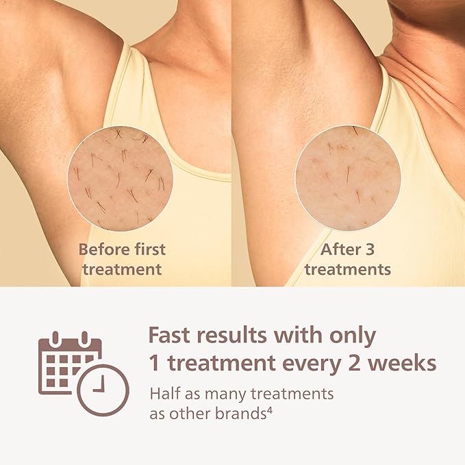 Philips Lumea 9000 Series IPL Hair Removal Device - Permanent Visible Hair Reduction Done at Home, SenseIQ Technology, 4 Attachments for Body, Face, Bikini & Underarms, for Women & Men, BRI984/03