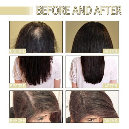 120ML Natural Hair Growth, Rosemary Oil for Hair Growth Organic, Rosemary Oil for Dry Damaged Hair and Growth Thin Hair （2PCS）