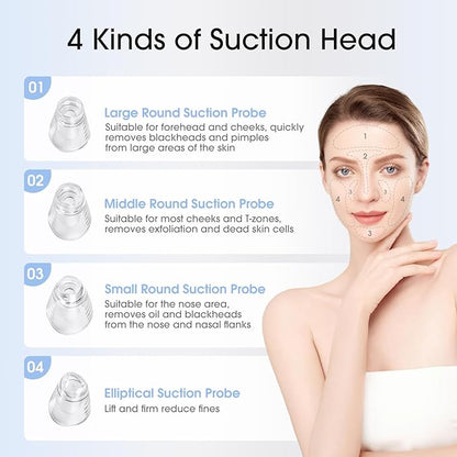 Yccu Blackhead Remover Vacuum Pore Extractor Black Head Remover for Face and Nose Blackhead Extractor Tool Pore Cleane Vacuum with USB Charge 4 Modes 5 Suction Heads for Women and Men (Black)