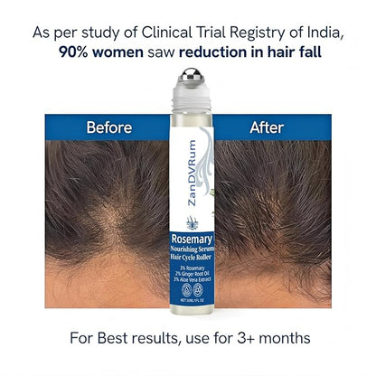 Rosemary Hair Growth Serum Roll-On for Thinning Hair with Saw Palmetto & Tea Tree — Lightweight, Non-Greasy Scalp Oil for Hair Regrowth Support