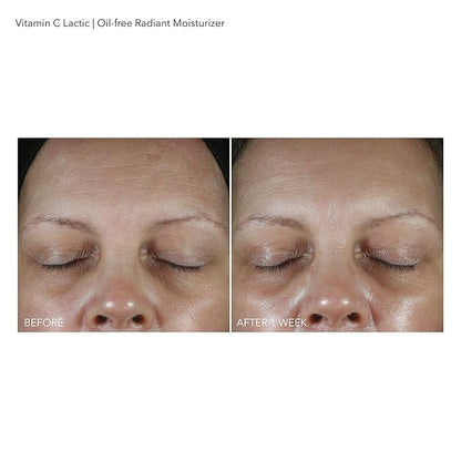 Dr Dennis Gross Vitamin C Lactic Oil-Free Radiant Moisturizer: For Dullness, Uneven Tone & Texture, Fine Lines and Occasional Dryness, 1.7 oz