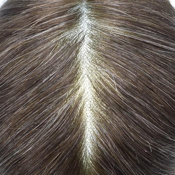 FACE MIRACLE Toupee for Men French Lace Hairpiece Human Hair Replacement System Skin PU Mens Toupee Hair Wigs for Man V-Looped Front Hair Prosthesis 7"X9" #340 Dark Brown with 40% Gray