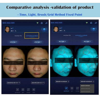 15.6" Professional Skin Analysis Device for Beauty Salons & Spas – AI-Powered 7-Spectral Imaging, 17 Skin Indicators, Multi-Language & Cloud Report Storage