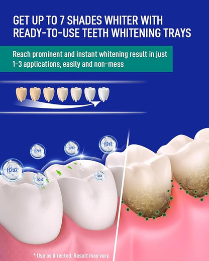 MySmile 7 Treatment Prefilled Teeth Whitening Trays 12% Hydrogen Peroxide and Fluoride Free Nano Hydroxyapatite Toothpaste Combo for Sensitive Teeth Relief, Enamel Repair and Teeth Remineralization