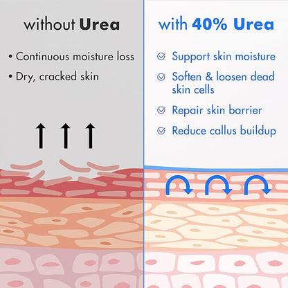 Ebanel Urea Cream 40% plus Salicylic Acid 2%, Foot Cream for Dry Cracked Heels Feet Knees Elbows Hands, Foot Dead Skin Cuticle Callus Remover Toenail Softener, Keratolytic Skin Barrier Repair, 3-Pack