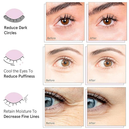 grace & stella Under Eye Mask - Reduce Dark Circles, Puffy Eyes, Undereye Bags, Wrinkles - Gel Under Eye Patches, Vegan Cruelty-Free Self Care (72 Pairs, GoldPinkBlue)