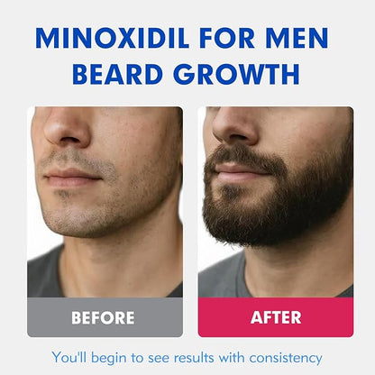 5% Minoxidil for Men Hair Regrowth Treatment, Extra Strength Topical Solution for Thinning Hair & Balding, Beard Growth Enhancer, Non-Greasy Fast-Absorbing Formula, 4-Pack (240ml) 4-Month Supply