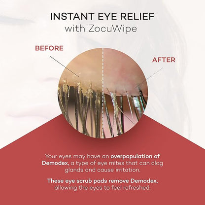 Zocular - Zocuwipe Eyelid Wipes with Natural Okra Complex - Eyelid Cleanser and Moisturizer Pads - Eyelid Cleansing Wipes - Blepharitis Treatment - 40ct