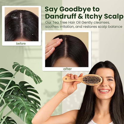 Natural Riches Tea Tree Oil for Hair - Blended with Vitamin E and Castor Oil for Hair Growth - Tea Tree Scalp Treatment for Dry Scalp - Lightweight Scalp Oil for Healthy, Strong Hair - 8 fl oz