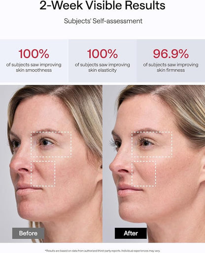 JMOON Microcurrent Facial Device, M30U Red Light Therapy for Face, Safe Anti Aging Skin Care, 4 Modes, 5 Energy Levels for Full Face Lift and Ideal for Smile Lines, Eyes, and Forehead (Red)